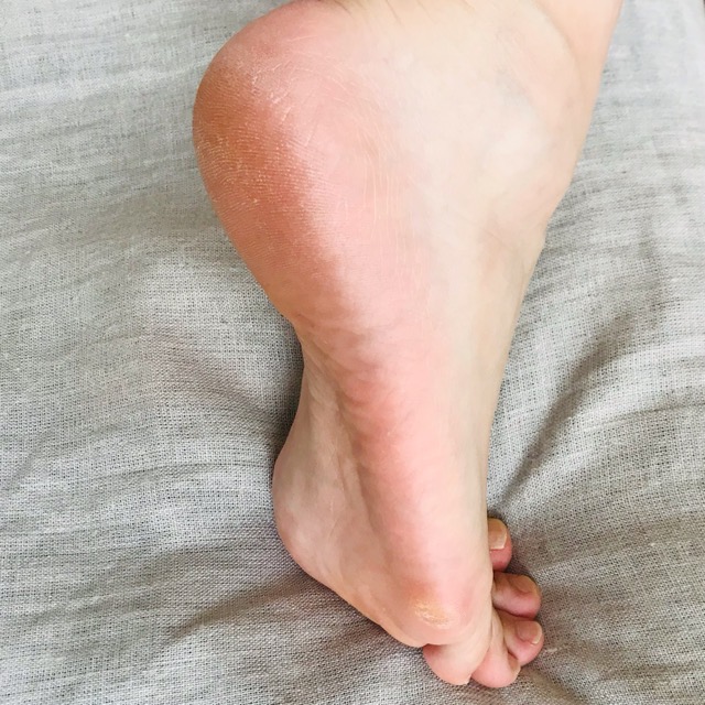 ６月になったら注意すること！